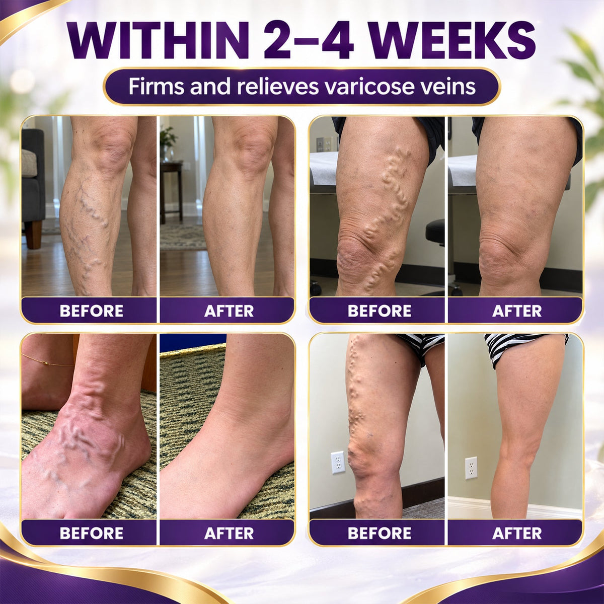 LUHAKA™ VeinRelief Cooling Herbal Leg Gel