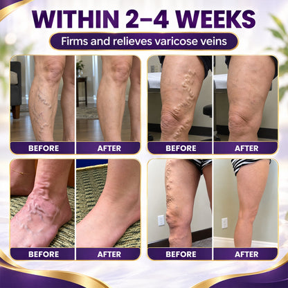 LUHAKA™ VeinRelief Cooling Herbal Leg Gel