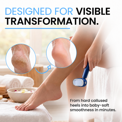 Dual‑Sided Foot Callus Remover, Replaceable Stainless Steel Blade Foot Scraper 🦶